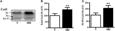 Anti-arrhythmic Cardiac Phenotype Elicited by Chronic Intermittent Hypoxia Is Associated With Alterations in Connexin-43 Expression, Phosphorylation, and Distribution